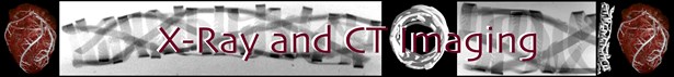 X-Ray and CT Imaging Title X-Ray and CT Imaging Title